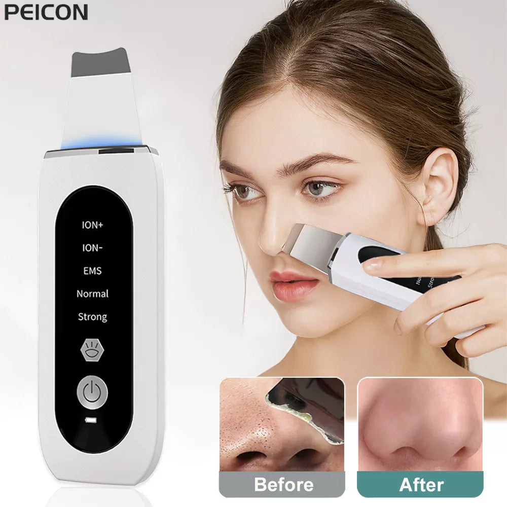 Ultrasonic Skin Scrubber Peeling